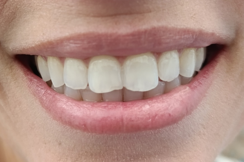 https://www.instagram.com/aversano_designer_del_sorriso/